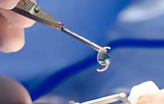 What is intraocular lens implantation_