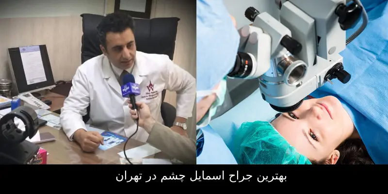 بهترین جراح اسمایل چشم