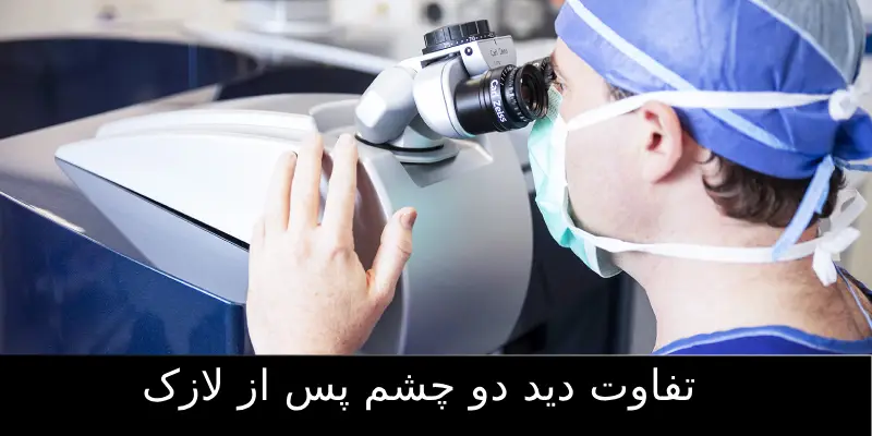 بهترین جراح لازک چشم