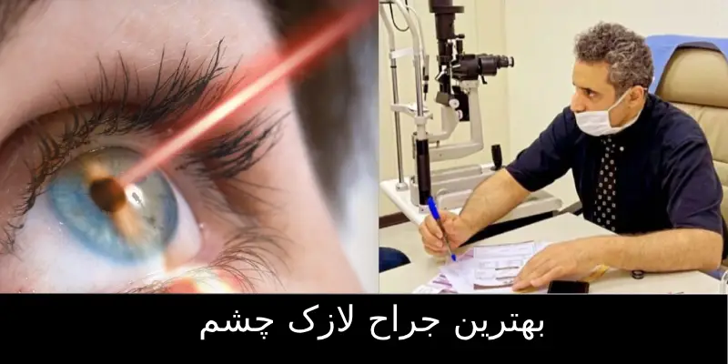 بهترین جراح لازک چشم