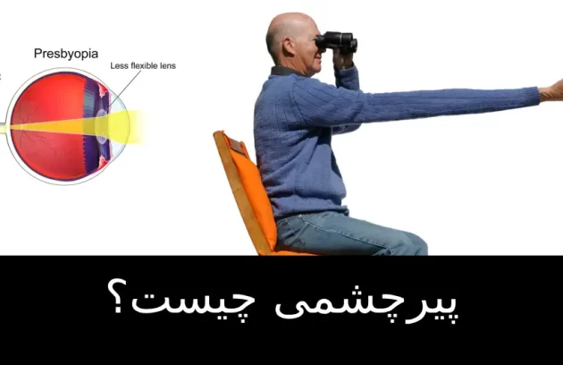 پیرچشمی چیست؟