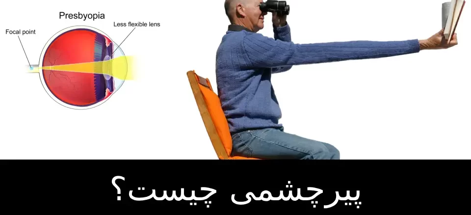 پیرچشمی چیست؟