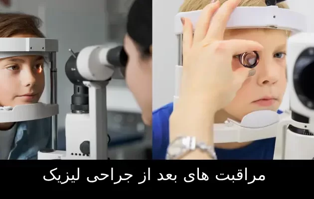 مراقبت های بعد از جراحی لیزیک