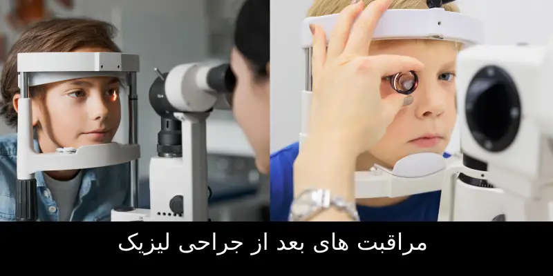 مراقبت های بعد از جراحی لیزیک