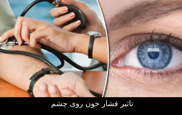 تاثیر فشار خون روی چشم