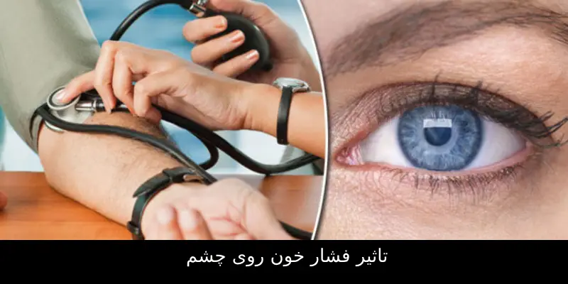 تاثیر فشار خون روی چشم