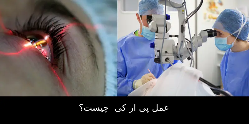 عمل پی ار کی  چیست ؟