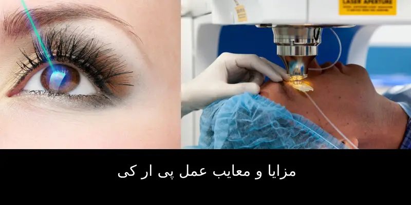 عمل پی ار کی  چیست ؟