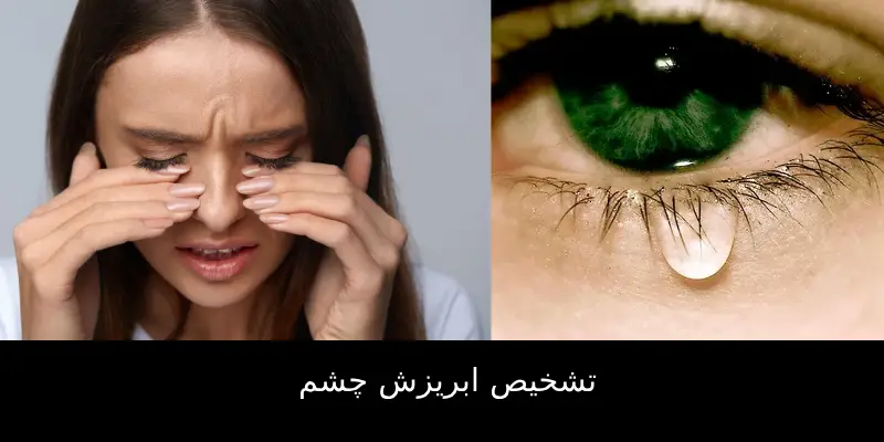 آبریزش چشم