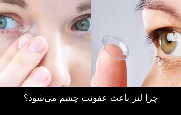 چرا لنز باعث عفونت چشم می‌شود؟