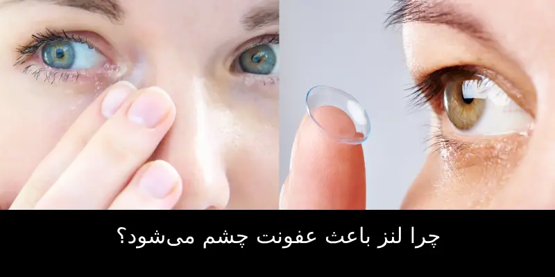 چرا لنز باعث عفونت چشم می‌شود؟