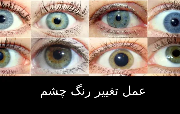 عمل تغییر رنگ چشم