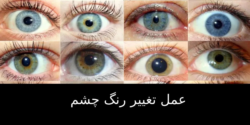 عمل تغییر رنگ چشم