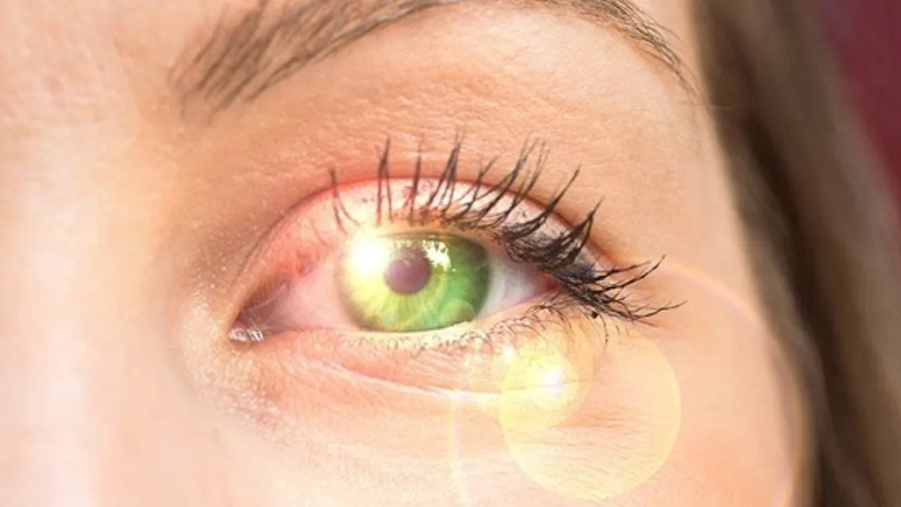 خطرات اشعه UV برای چشم‌ها